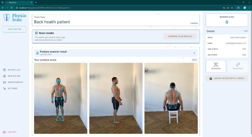 PhysioScan posture scanner results with multi-angle patient photos and skeletal overlay analysis